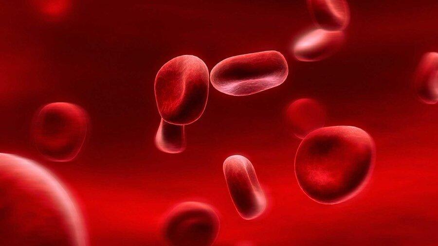 چرا درمان کم خونی در روزهای کرونایی اهمیت دارد؟