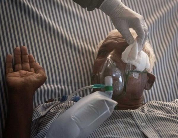 شناسایی 20 بیمار مبتلا به قارچ سیاه در مشهد